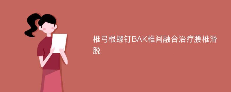 椎弓根螺钉BAK椎间融合治疗腰椎滑脱